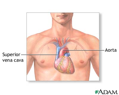 Normal anatomy