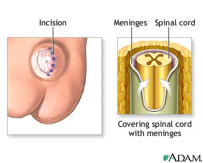 Procedure