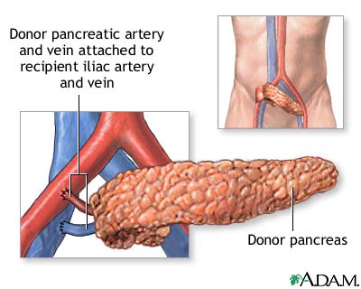 Procedure, part 2