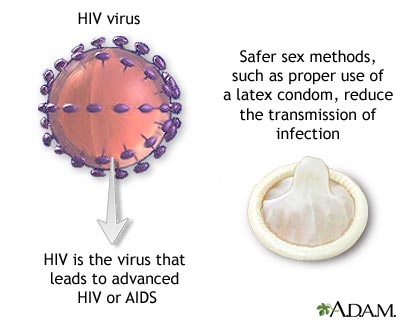 HIV