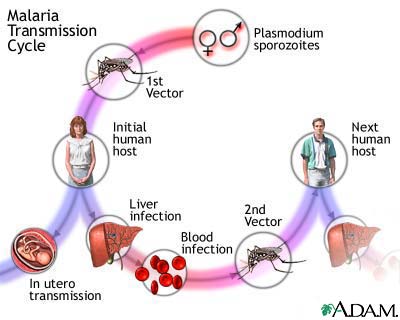 Malaria