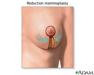 Procedure