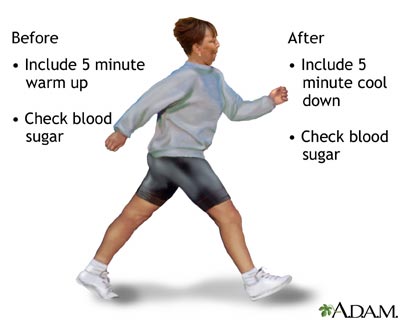 Diabetes and exercise