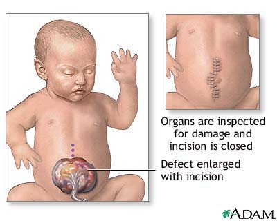 Procedure