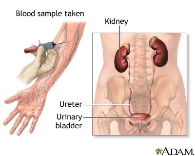 Kidney function tests