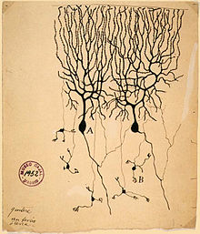 A drawing on yellowing paper with an archiving stamp in the corner. A spidery tree branch structure connects to the top of a mass. A few narrow processes follow away from the bottom of the mass.