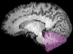 Cerebellum sag.jpg